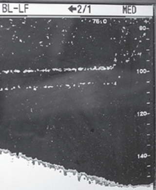 魚群探知機の写真