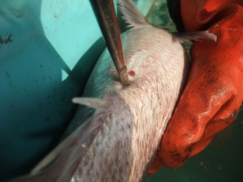 ハリを刺す写真