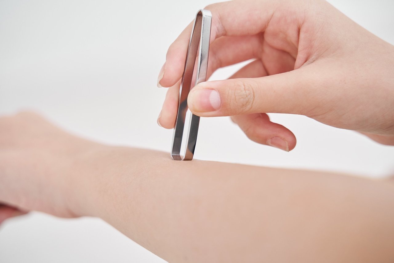 ピンセットと腕の写真