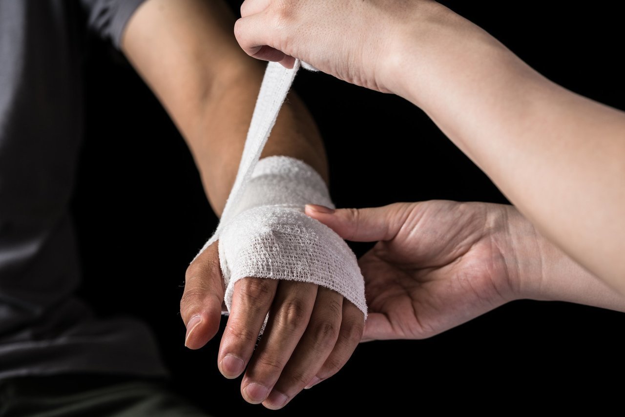 手を怪我した写真